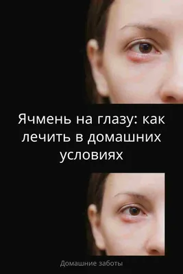 Окомистин капли глазные, ушные, назальные 0,01% 10 мл - купить в Москве и  регионах по цене от 246 руб., инструкция по применению, описание