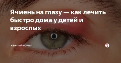 Как нельзя лечить ячмень на глазу