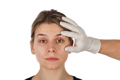 Ячмень на глазу (гордеолум): симптомы, причины и лечение у взрослых в ФНКЦ  ФМБА