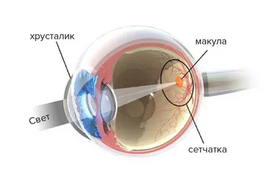 У вас ячмень и вы хотите быстро его вылечить? Мы знаем как!