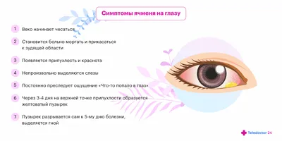 Ячмень на глазу (гордеолум): симптомы, причины и лечение у взрослых в ФНКЦ  ФМБА