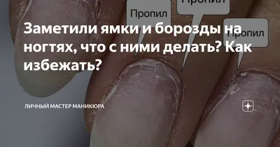 Белые точки и полоски на ногтях