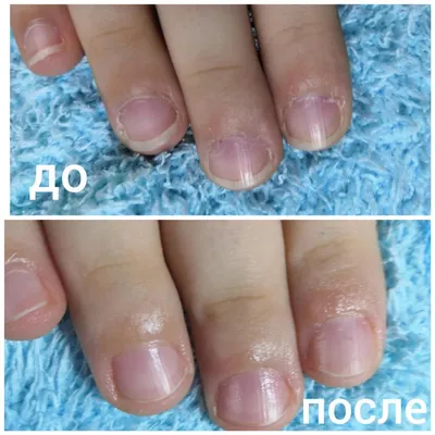 Японский маникюр P-Shine. Красивые ногти без покрытия вредными гель-лаками  (очень длинный пост с подробными фотографиями) | Отзывы покупателей |  Косметиста