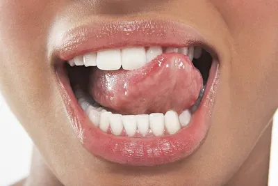 Рана на небе - Вопрос стоматологу - 03 Онлайн