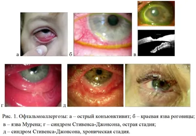 👁Расплавляющая язва роговицы... - Биота ветеринарная клиника | Facebook