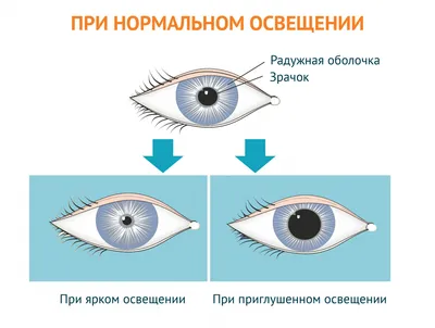 Как лечить язвы роговицы глаз. Барселона | ICR