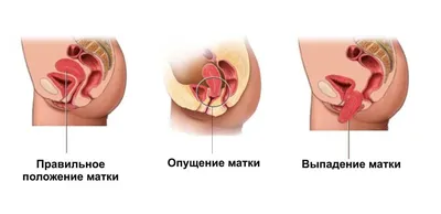 Всё о язвах во рту - причины, лечение, профилактика - блог «ДИНАСТИЯ»