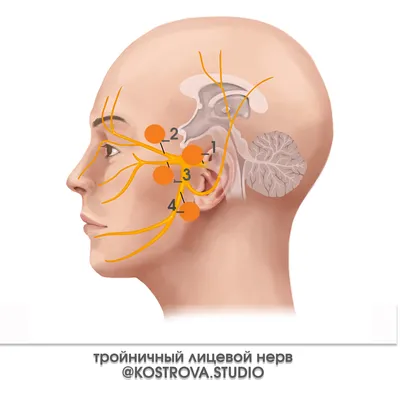 Лечение невралгии тройничного нерва | Клиника доктора Селезнёва