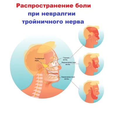 Клиника «Жёлтый Император»Иглоукалывание при гайморите – клиника китайской  медицины «Желтый император»