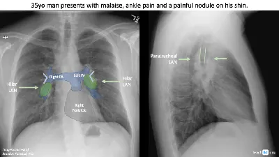 Robotic X-ray imaging - Siemens Healthineers