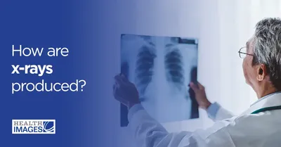 Smart X-ray workflow helps reduce variability and imaging errors | GE  HealthCare (United States)