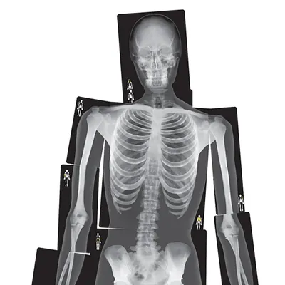 Chest x-ray Archives - teachIM