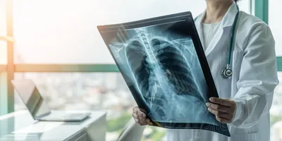 True-to-Life Human X-Rays - Montessori Services