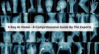 What Is the Difference Between a Digital X-ray and a Standard X-ray? |  Corner Stone Urgent Care Center