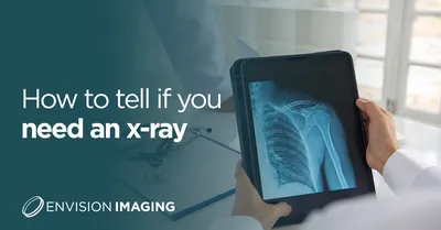 Prime Video X-Ray