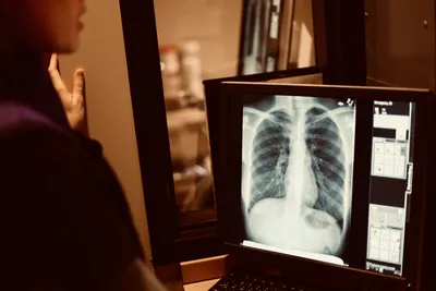 NIH Clinical Center provides one of the largest publicly available chest  x-ray datasets to scientific community | National Institutes of Health (NIH)