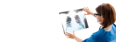 Chest X-Ray | Cardiovascular Medical Group of Southern California