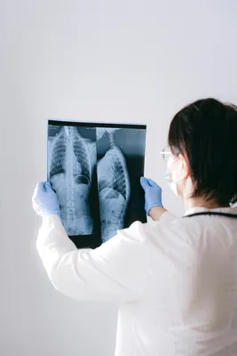 What Do Chest X-Rays Show?