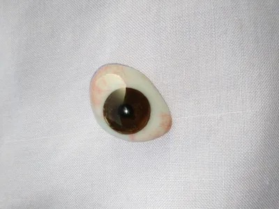 Операции по изменению цвета глаз Имплантаты Iris