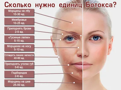 Инъекции Ботокса, Диспорта - коррекция мимических морщин в Москве - клиника  “Косметомед”
