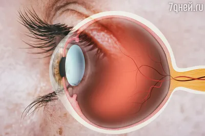 Изменение в сетчатке глаз могут показать будущий инфаркт - 7Дней.ру