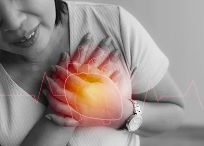 Размышления о том, что лучше не сидеть с болями в сердце дома или инфаркт  глазами рентгенхирурга | Пикабу