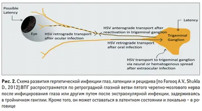 Инфекционные заболевания глаз «Ochkov.net»