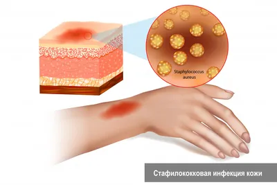 Неделя профилактики кожных заболеваний | Долг врача в том, чтобы лечить  безопасно, качественно, приятно