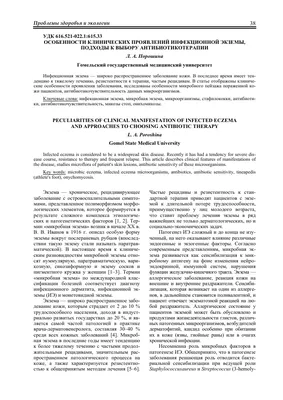 Экзема: причины, чем лечить и мазать, как выглядит экзема на руках, ногах,  лице и пальцах