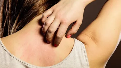 Высыпания на коже: на теле, на лице. Причины и симптомы сыпи на коже