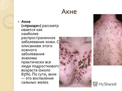 Интоксикация организма - причина болезней, МЦ Альтернатива, Киев