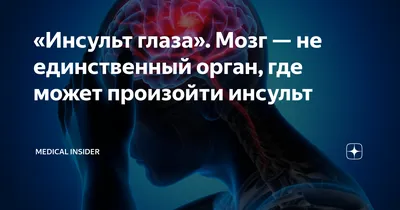 ИИ предскажет инсульт. Просто заглянув в глаза