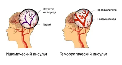 Первая помощь при попадании инородных тел и травмах глаз