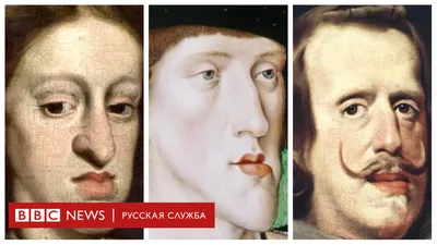 Габсбургская челюсть\" - результат инцеста. Как выродилась могущественная  династия Европы - BBC News Русская служба