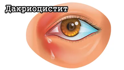 Самые частые травмы глаз: какие требуют экстренного лечения? - Всё о зрении.