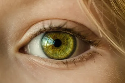 Впервые в Израиле: пересадка роговицы глаза, обеспечивающая 100%-ное зрение!