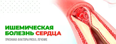 Ишемическая болезнь сердца (ИБС): симптомы, лечение, признаки