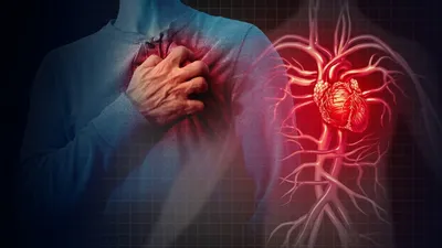 Ишемическая болезнь сердца. Как избежать катастрофы? - kldcardio