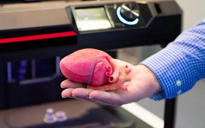 В США впервые трансплантировали полностью искусственное сердце | РБК Тренды
