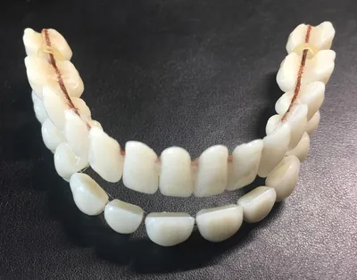 Искусственные зубы фото фото