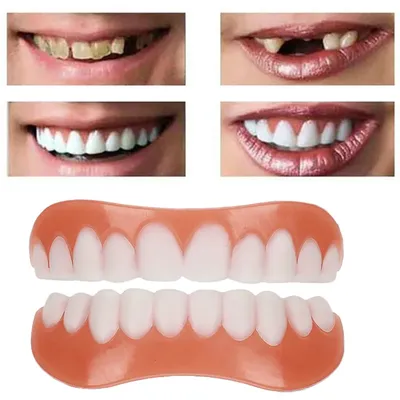 Искусственные зубы Sdotter, силиконовые верхние и нижние виниры, зубные  скобы, протезы, протезы, временные искусственные зубы, отбеливание зубов |  AliExpress