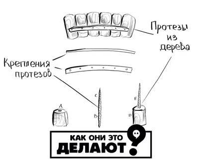 Протезирование зубов (ортопедическая стоматология)