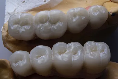 Искусственные зубы на белой таблице Стоковое Фото - изображение  насчитывающей устно, микстура: 43796086