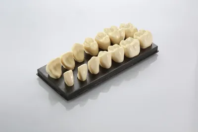 Установка имплантов, протезирование зубов цена в Москве в X-Dent
