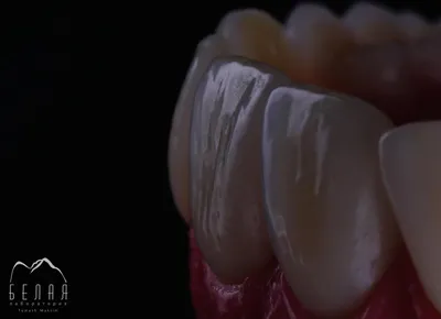Искусственные зубы \"Anis\" | NewDental