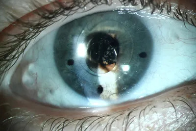 Купить MILL CREEK Цветные контактные линзы Красивый зрачок Косметические  линзы для глаз Искусственный зрачок Степень Контакты Рецепт Близорукость |  Joom