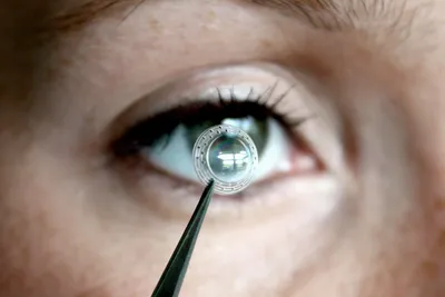 Обзор искусственных хрусталиков | «Первая глазная клиника»