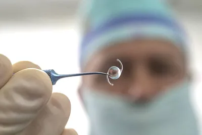 Массовый выпуск импортозамещенных искусственных хрусталиков, разработанных  офтальмологами Петербурга, начнется в ближайшее время - Российская газета