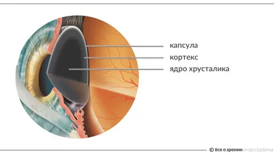 К 60-летию первой операции по имплантации искусственного хрусталика глаза  МНТК \"Микрохирургия глаза\"