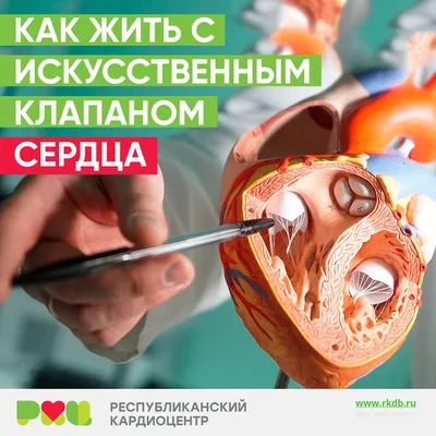 Файл:Aortic Karboniks-1 bileafter prosthetic heart valve.jpg — Википедия